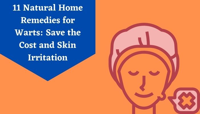 11 Natural Home Remedies for Warts Save the Cost and Skin Irritation