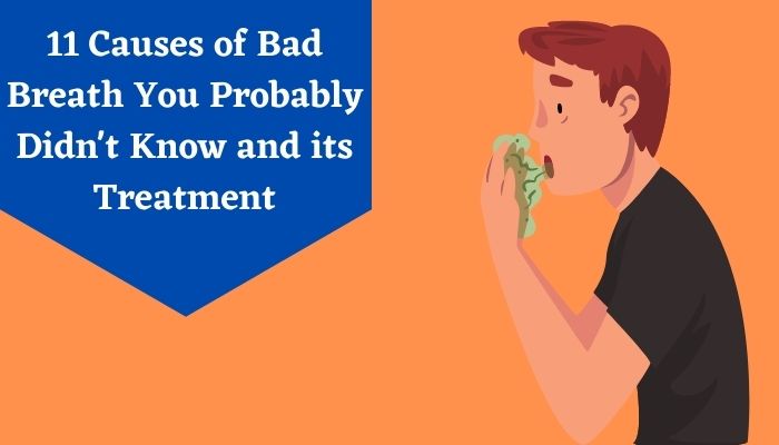 Bad breath causes and its treatment 