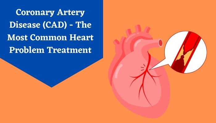 Coronary Artery Disease (CAD) - The Most Common Heart Problem Treatment