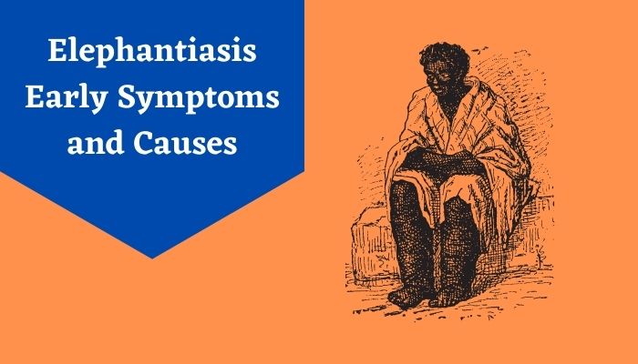 Elephantiasis Early Symptoms and Causes