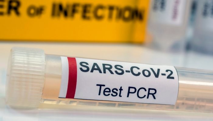 RT-PCR Test For Coronavirus