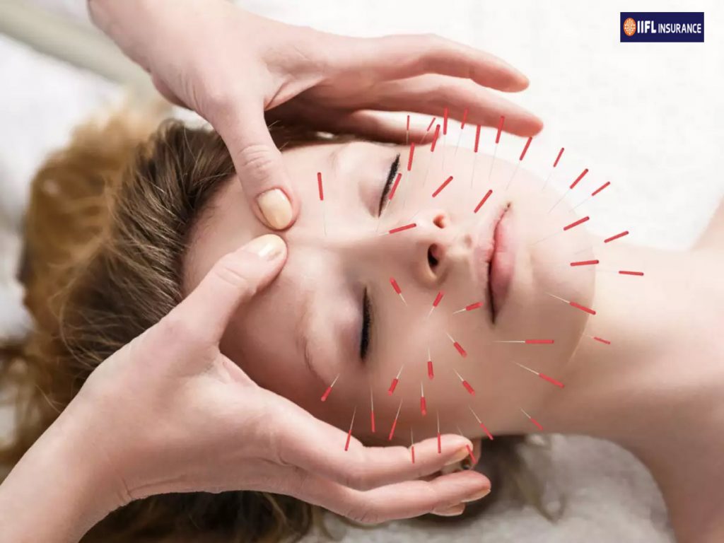 How Does Acupuncture Therapy Work?